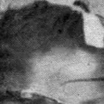 Addie Mae Collins: A Victim of the Birmingham Bombing