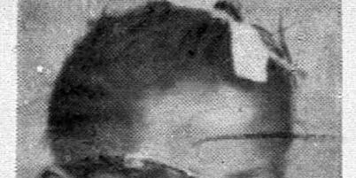 Addie Mae Collins: A Victim of the Birmingham Bombing