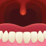 Dangly Thing: Uncovering the Science Behind Your Uvula