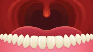 Dangly Thing: Uncovering the Science Behind Your Uvula