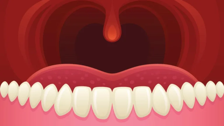 Dangly Thing: Uncovering the Science Behind Your Uvula