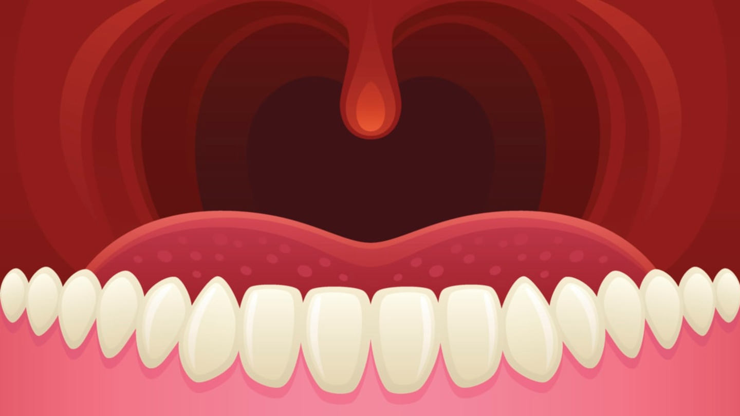 Dangly Thing: Uncovering the Science Behind Your Uvula