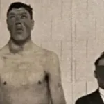 Adam Rainer: Giant Dwarfism