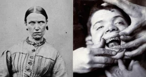 What Does an Insane Asylum Look Like? Horrifying Asylum Stories Revealed
