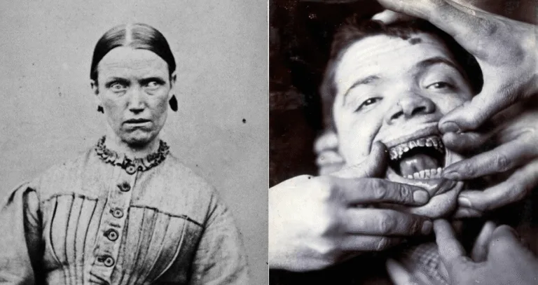 What Does an Insane Asylum Look Like? Horrifying Asylum Stories Revealed
