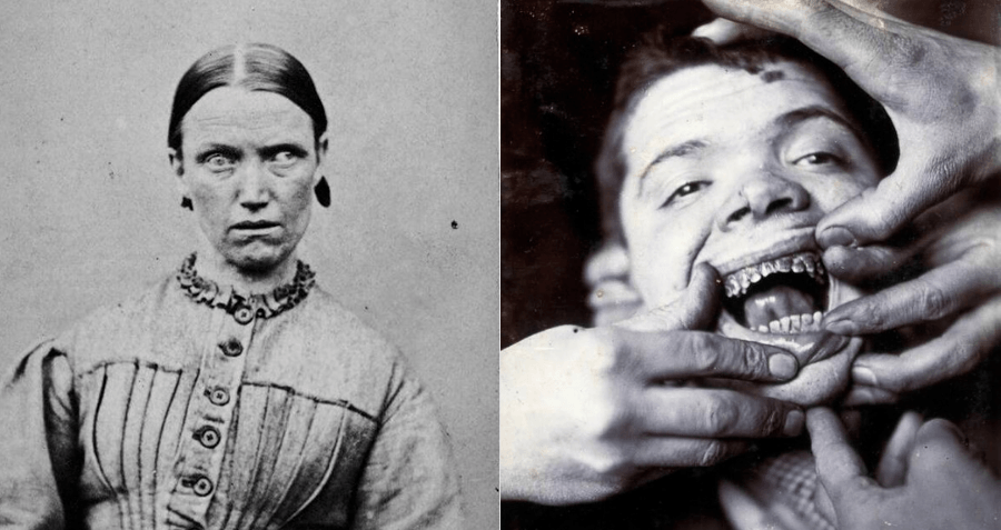 What Does an Insane Asylum Look Like? Horrifying Asylum Stories Revealed