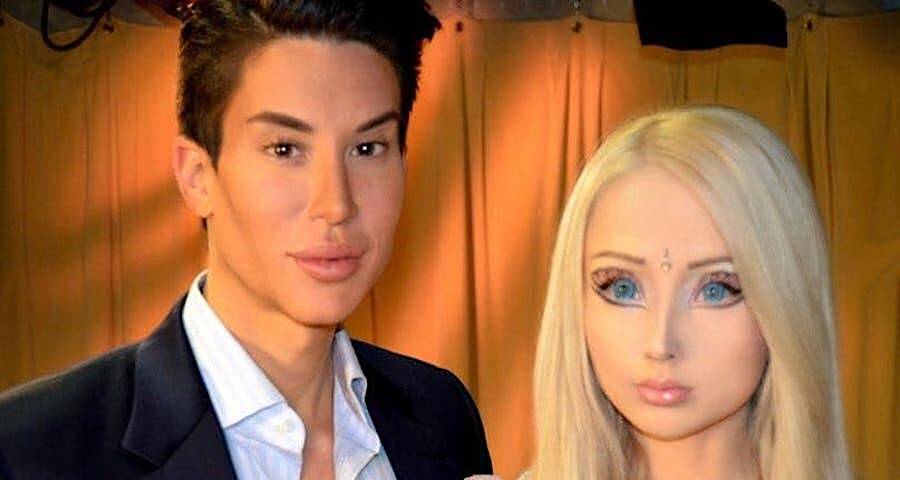Real Life Barbie & Ken: Plastic Surgery