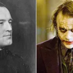 Glasgow Smile Scars: Real History and Modern Violence