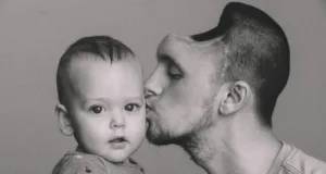 Man Who Drank Too Many Energy Drinks Survives Brain Hemorrhage