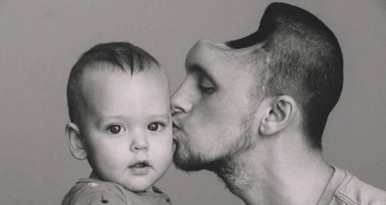 Man Who Drank Too Many Energy Drinks Survives Brain Hemorrhage