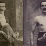 Jean and Jacques Libbera: The Fascinating Story of a Double-Bodied Man