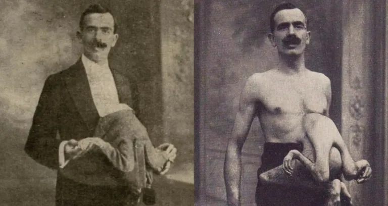 Jean and Jacques Libbera: The Fascinating Story of a Double-Bodied Man