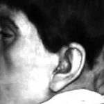 Edward Mordrake Real or Fake: Man With 2 Faces – Legend Debunked