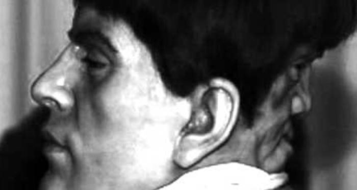 Edward Mordrake Real or Fake: Man With 2 Faces - Legend Debunked