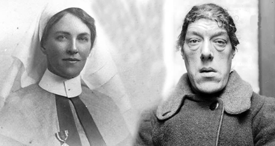 Mary Ann Bevan Story: The Ugliest Woman in the World