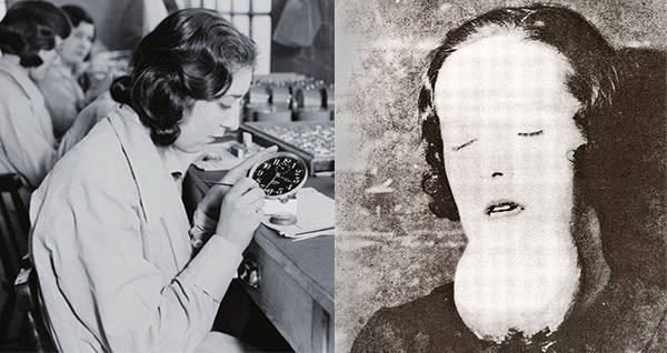 Molly Radium Jaw: The Tragic Story of Industrial Exposure