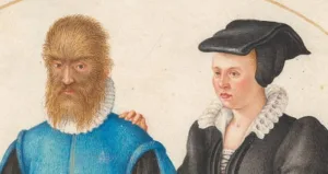 Petrus Gonsalvus and His Bride-to-Be Catherine: A 16th-Century Love Story