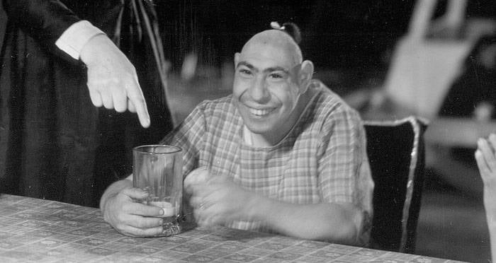 Pinhead Deformity: The Life & Legacy of Schlitzie the Sideshow Star