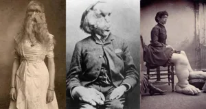 Real Freaks: A Look at Real Freak Shows and Their History