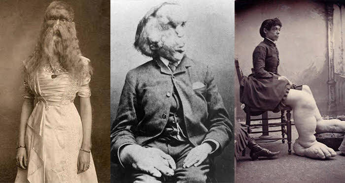 Real Freaks: A Look at Real Freak Shows and Their History