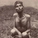 Dina Sanichar Teeth: Real Life Mowgli Story Jungle Book True