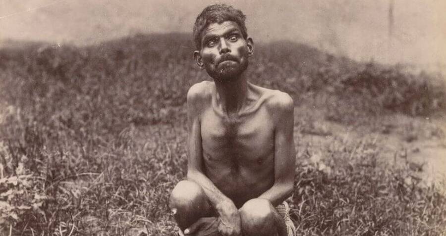 Dina Sanichar Teeth: Real Life Mowgli Story Jungle Book True