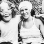 How Did Rocky Dennis Die: Mask Movie True Story & Real Life