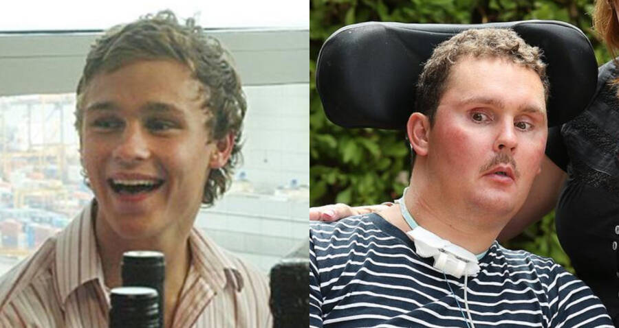 Sam Ballard Rugby: Tragic Impact of Rat Lungworm Infection