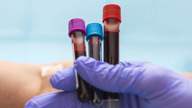 Blood Type Linked To Higher Risk Of Memory Problems