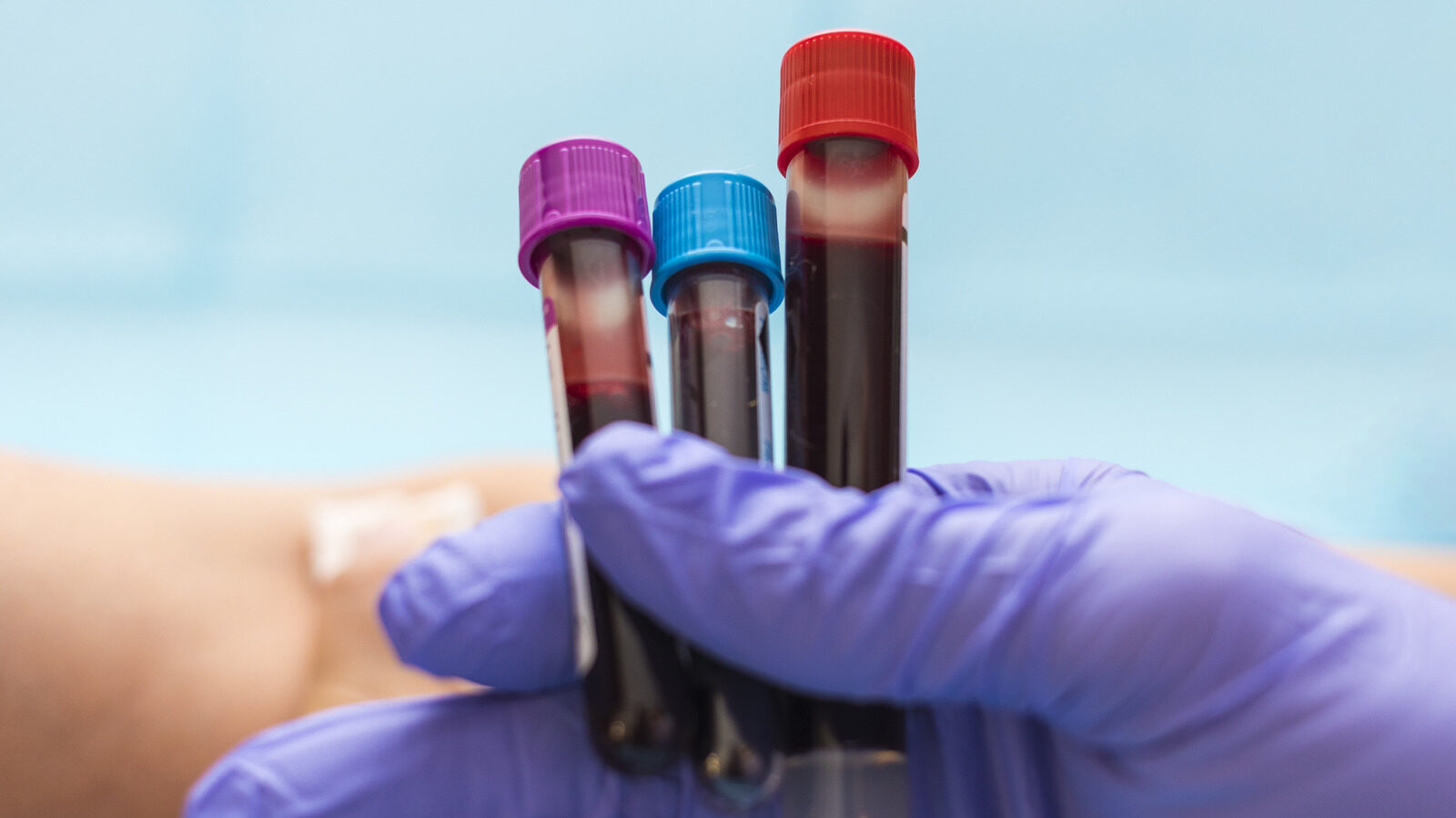 Blood Type Linked To Higher Risk Of Memory Problems