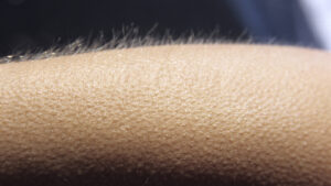 The Body Part That Explains Why Humans Get Goosebumps