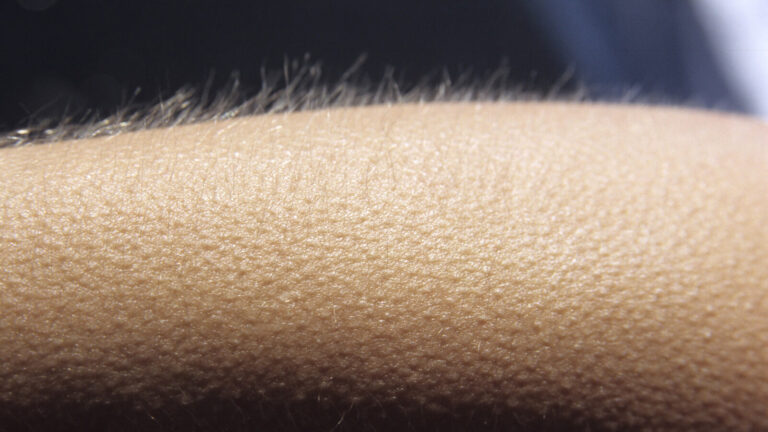 The Body Part That Explains Why Humans Get Goosebumps