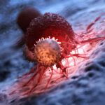 Blood Type Linked To Increased Risk Of Stomach Cancer