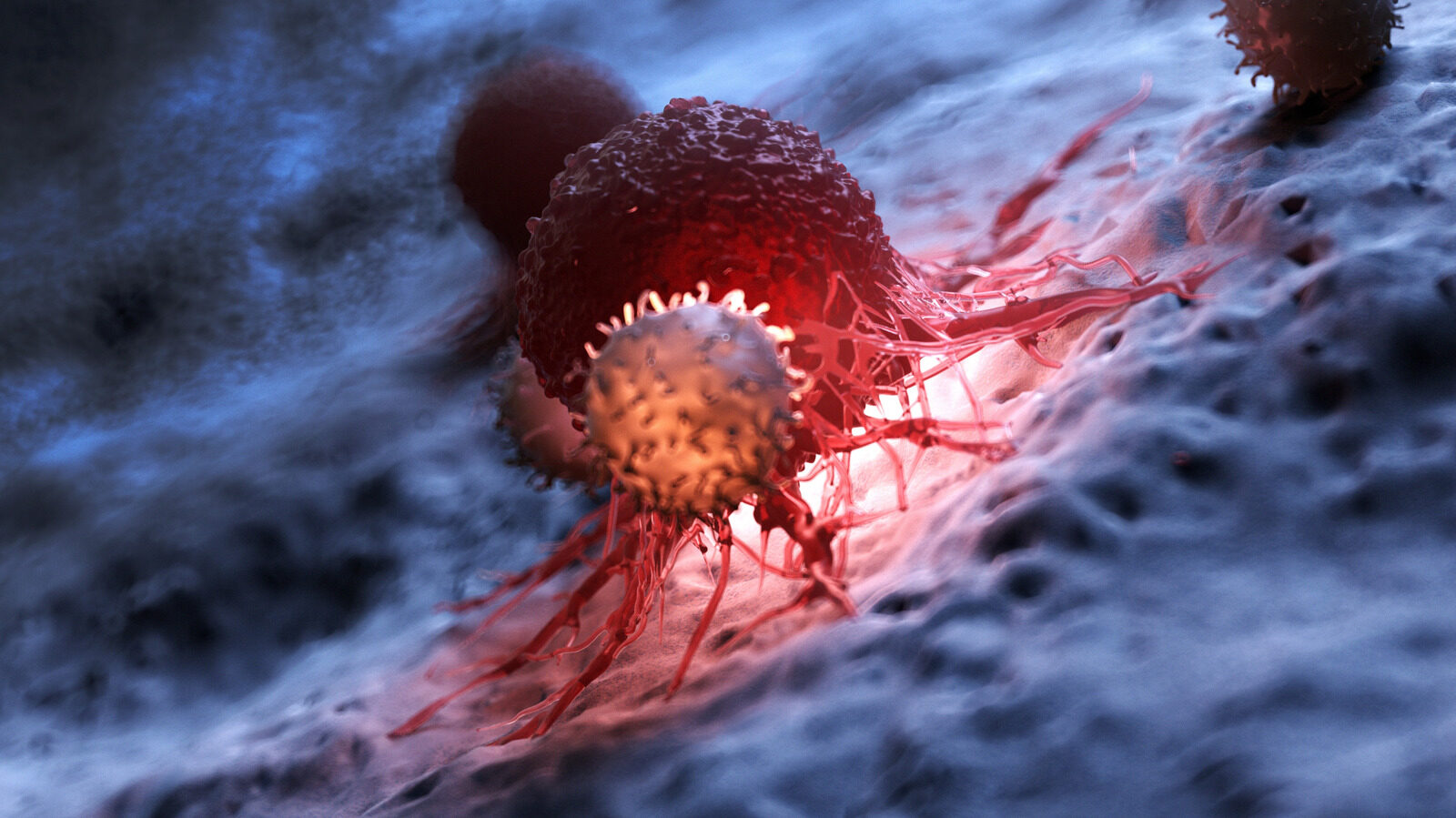 Blood Type Linked To Increased Risk Of Stomach Cancer