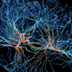 Simple Speech Pattern May Indicate Risk Of Cognitive Decline