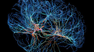 Simple Speech Pattern May Indicate Risk Of Cognitive Decline