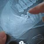 The Organ That Can Cause More Harm Than Good