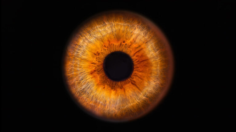 Unique Eye Trait Found In Only 50 Percent Of People