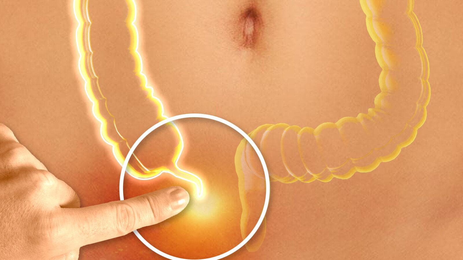 The Importance Of Your Appendix More Useful Than You Think