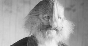 Historical portrait of Stephan Bibrowski, the Lion-Faced Man, showing his distinctive facial hair and formal clothing.